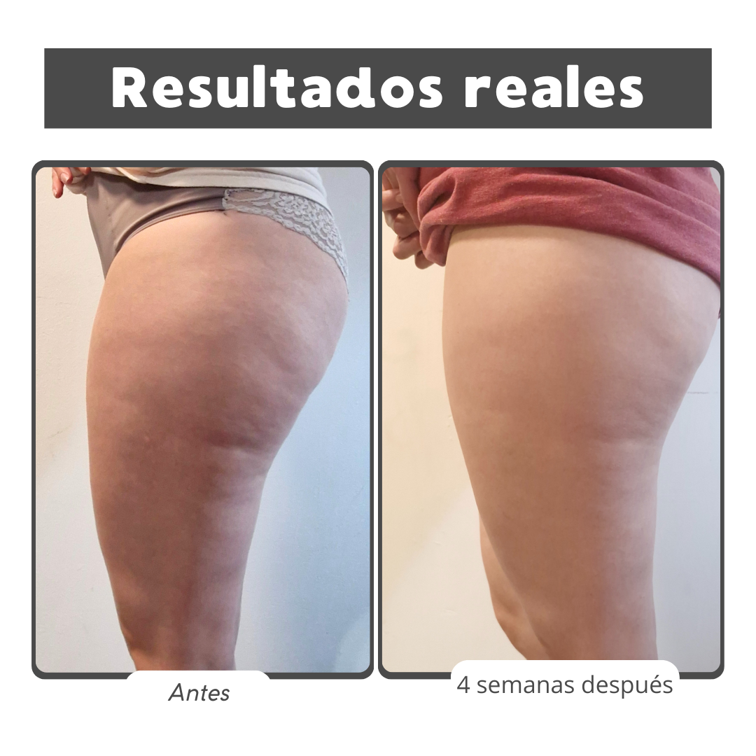 Reafirma 24/7 Kit Reafirmante Herbal - Gel y Aceite Natural para Celulitis y Firmeza