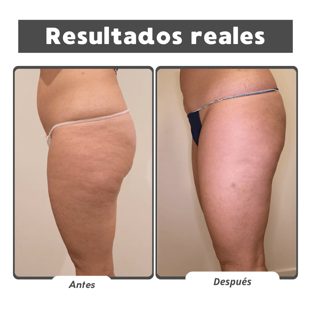 Reafirma 24/7 Kit Reafirmante Herbal - Gel y Aceite Natural para Celulitis y Firmeza