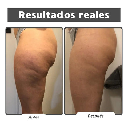 Reafirma 24/7 Kit Reafirmante Herbal - Gel y Aceite Natural para Celulitis y Firmeza