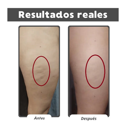 Reafirma 24/7 Kit Reafirmante Herbal - Gel y Aceite Natural para Celulitis y Firmeza